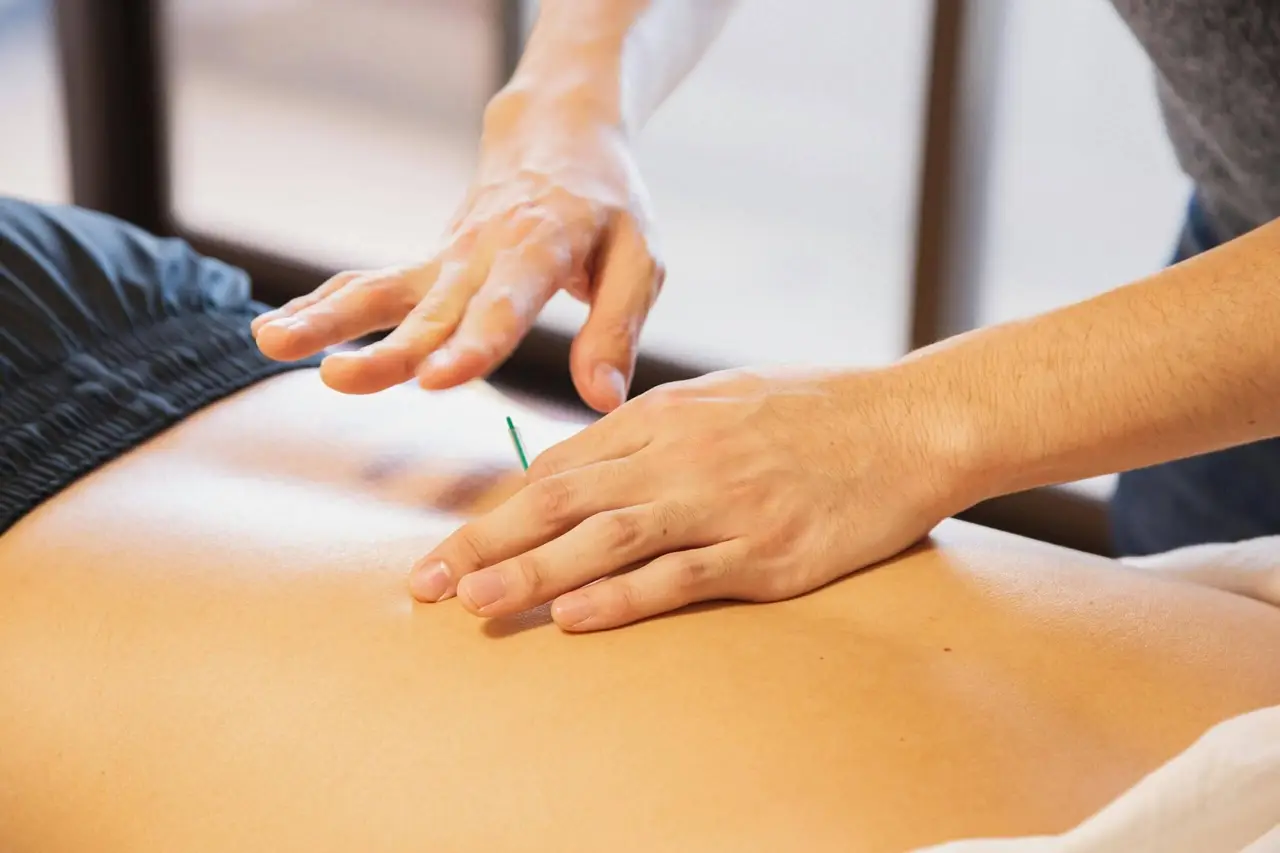 Dry Needling – Gezielte Triggerpunkt-Therapie zur Linderung von Muskelverspannungen und Schmerzen.